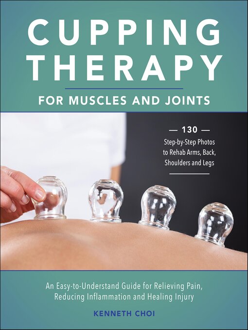 Cover image for Cupping Therapy for Muscles and Joints